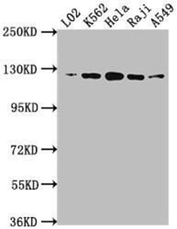 ATP Citrate Lyase Antibody (3A5), Novus Biologicals:Antibodies:Primary