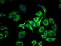 ATP Citrate Lyase Antibody (3A5), Novus Biologicals:Antibodies:Primary