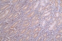 SOD2/Mn-SOD, ac Lys68 Antibody (23G5), Novus Biologicals:Antibodies:Primary