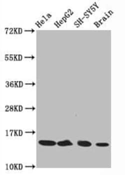 Histone H3.1, ac Lys14 Antibody (3H3), Novus Biologicals 100 &mu;L; Unconjugated:Antibodies,