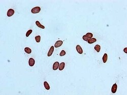 Histone H3.1, ac Lys14 Antibody (3H3), Novus Biologicals 100 &mu;L; Unconjugated:Antibodies,