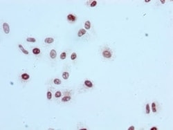 Histone H3.1, ac Lys56 Antibody (3H2), Novus Biologicals:Antibodies:Primary