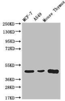 ACAA2 Antibody (12F4), Novus Biologicals 50 &mu;L; Unconjugated:Antibodies,