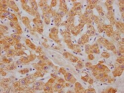 ABAT Antibody (5B6), Novus Biologicals:Antibodies:Primary Antibodies