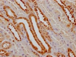 Glutathione S-Transferase pi 1/GSTP1 Antibody (8F6), Novus Biologicals:Antibodies:Primary