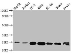 Glutathione S-Transferase pi 1/GSTP1 Antibody (8F6), Novus Biologicals:Antibodies:Primary