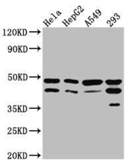 GSK-3 beta Antibody (9G11), Novus Biologicals 50 &mu;L; Unconjugated:Antibodies,