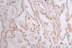 Glucose 6 phosphate isomerase Antibody (12A4), Novus Biologicals:Antibodies:Primary