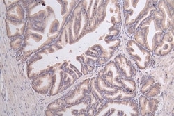 Glucose 6 phosphate isomerase Antibody (12A4), Novus Biologicals:Antibodies:Primary