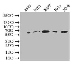 Glucose 6 phosphate isomerase Antibody (12A4), Novus Biologicals:Antibodies:Primary