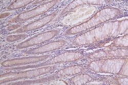 alpha-Galactosidase A/GLA Antibody (30H11), Novus Biologicals 50 &mu;L;