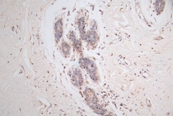 LYAG/GAA Antibody (5E5), Novus Biologicals:Antibodies:Primary Antibodies
