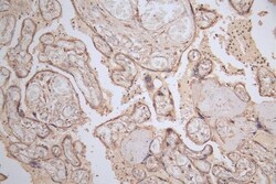 LYAG/GAA Antibody (5E5), Novus Biologicals:Antibodies:Primary Antibodies