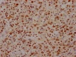FUBP1 Antibody (7C3), Novus Biologicals 100 &mu;L; Unconjugated:Antibodies,