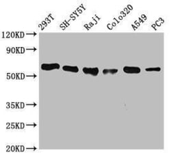 FTO Antibody (4G9), Novus Biologicals 50 &mu;L; Unconjugated:Antibodies,