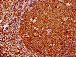 FOXO3 Antibody (1E2), Novus Biologicals:Antibodies:Primary Antibodies