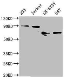 FOXO3 Antibody (1E2), Novus Biologicals:Antibodies:Primary Antibodies