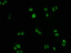 FOXO3 Antibody (1E2), Novus Biologicals:Antibodies:Primary Antibodies