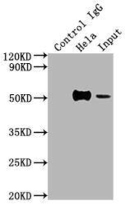 HNF-3 alpha/FoxA1 Antibody (3B2), Novus Biologicals 50 &mu;L; Unconjugated:Antibodies,
