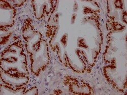 HNF-3 alpha/FoxA1 Antibody (3B2), Novus Biologicals 50 &mu;L; Unconjugated:Antibodies,