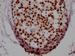 HNF-3 alpha/FoxA1 Antibody (3B2), Novus Biologicals 50 &mu;L; Unconjugated:Antibodies,