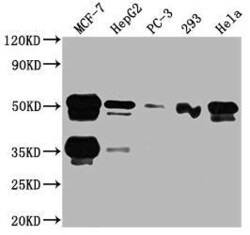 HNF-3 alpha/FoxA1 Antibody (3B2), Novus Biologicals 50 &mu;L; Unconjugated:Antibodies,