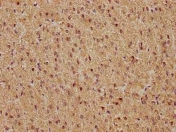 c-Fos Antibody (14C10), Novus Biologicals:Antibodies:Primary Antibodies