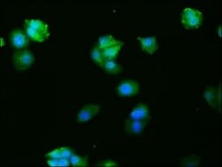 c-Fos Antibody (14C10), Novus Biologicals:Antibodies:Primary Antibodies