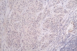 HIST1H3A, Formyl Lys122 Antibody (32C1), Novus Biologicals 100 &mu;L; Unconjugated:Antibodies,