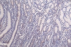 HIST1H3A, Formyl Lys122 Antibody (32C1), Novus Biologicals 100 &mu;L; Unconjugated:Antibodies,