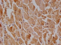 TTC11 Antibody (27B4), Novus Biologicals 100 &mu;L; Unconjugated:Antibodies,