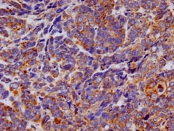 TTC11 Antibody (27B4), Novus Biologicals 100 &mu;L; Unconjugated:Antibodies,