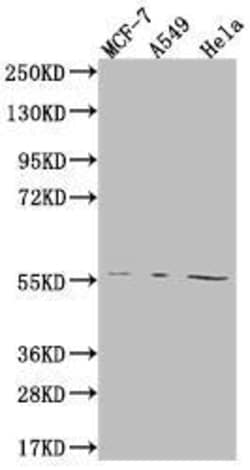FADS1 Antibody (7A10), Novus Biologicals:Antibodies:Primary Antibodies