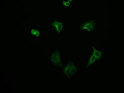 FADS1 Antibody (7A10), Novus Biologicals:Antibodies:Primary Antibodies