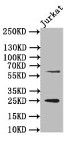 EBI3 Antibody (12H5), Novus Biologicals 50 &mu;L, Unconjugated:Antibodies,