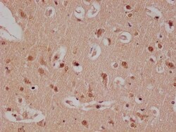 E2F-4 Antibody (24E12), Novus Biologicals:Antibodies:Primary Antibodies