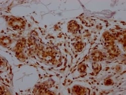E2F-1 Antibody (1D12), Novus Biologicals:Antibodies:Primary Antibodies