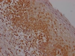 E2F-1 Antibody (1D12), Novus Biologicals:Antibodies:Primary Antibodies