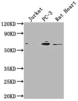 E2F-1 Antibody (1D12), Novus Biologicals:Antibodies:Primary Antibodies