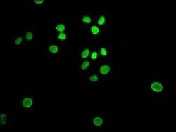 E2F-1 Antibody (1D12), Novus Biologicals:Antibodies:Primary Antibodies