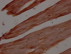 Dystrophin Antibody (4B10), Novus Biologicals:Antibodies:Primary Antibodies
