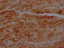Dystrophin Antibody (4B10), Novus Biologicals:Antibodies:Primary Antibodies