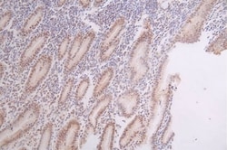 DEK Antibody (20D2), Novus Biologicals:Antibodies:Primary Antibodies