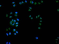 DEK Antibody (20D2), Novus Biologicals:Antibodies:Primary Antibodies