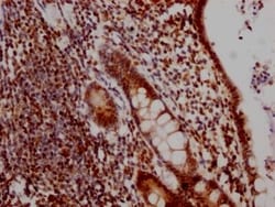 DDX5 Antibody (2C3), Novus Biologicals:Antibodies:Primary Antibodies