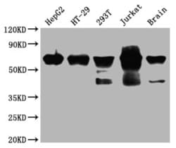 DDX5 Antibody (2C3), Novus Biologicals:Antibodies:Primary Antibodies