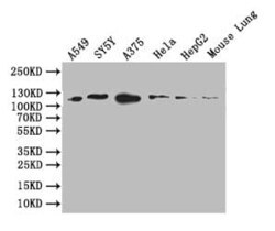 DDR2 Antibody (9A9), Novus Biologicals 100 &mu;L, Unconjugated:Antibodies,