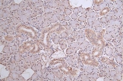 XPE/DDB2 Antibody (24E5), Novus Biologicals 50 &mu;L, Unconjugated:Antibodies,