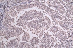 XPE/DDB2 Antibody (24E5), Novus Biologicals 50 &mu;L, Unconjugated:Antibodies,