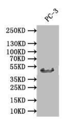 XPE/DDB2 Antibody (24E5), Novus Biologicals 50 &mu;L, Unconjugated:Antibodies,